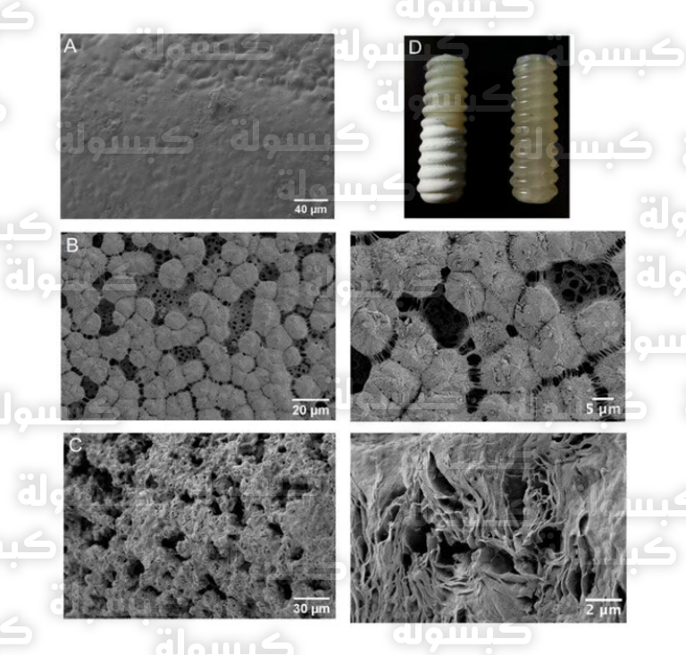 ابتكار مسامير حيوية قابلة للتحلل لتعزيز التئام العظام 