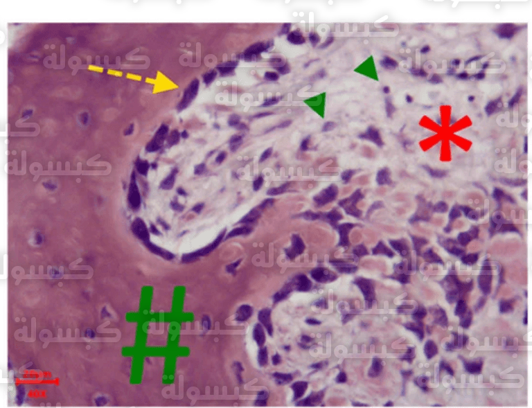 ابتكار مسامير حيوية قابلة للتحلل لتعزيز التئام العظام 
