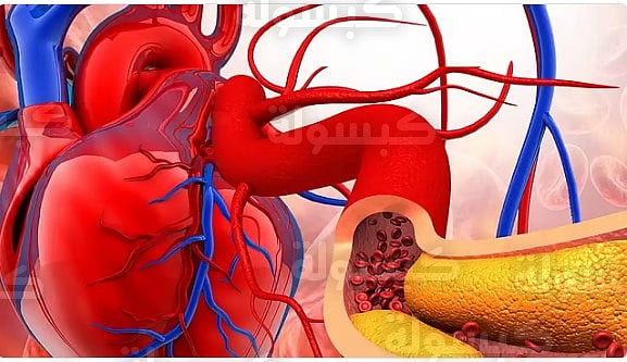 نصائح الدكتور فهد الخضيري للوقاية من تصلب الشرايين 2026
