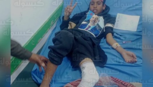 سقوط 10 قتلى وجرحى في صدامات ميدانية بمدينة عتق والمجلس الانتقالي يحمل الجهات الأمنية المسؤولية كاملة