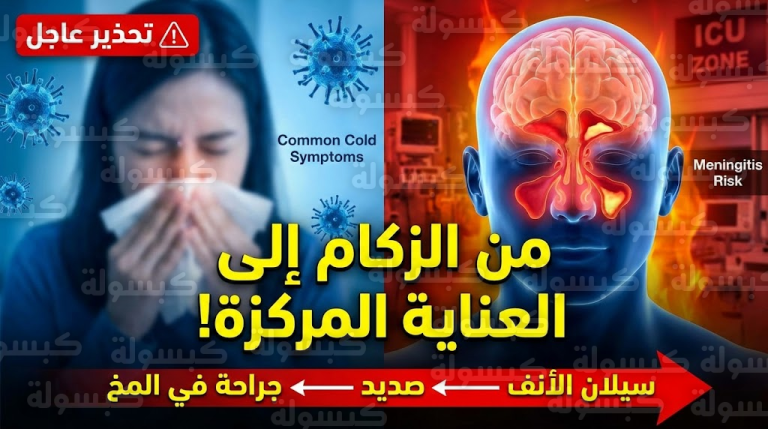 عاجل.. “سيلان الأنف” ليس عرضاً عابراً: طبيب يكشف كيف يقودك “الزكام” إلى العناية المركزة وجراحة المخ!